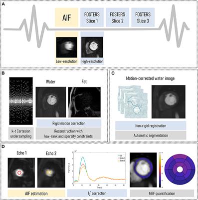 High-Resolution Free-Breathing Quantitative First-Pass Perfusion Cardiac MR Using Dual-Echo Dixon With Spatio-Temporal Acceleration